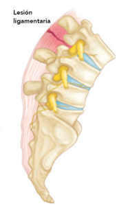 Dolor Lumbar  TMR Buenos Aires